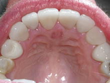 Towson General and Implant Dentistry | Emergency Treatment, CEREC reg and Invisalign reg