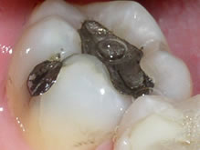 Towson General and Implant Dentistry | Teeth Whitening, Oral Exams and Veneers